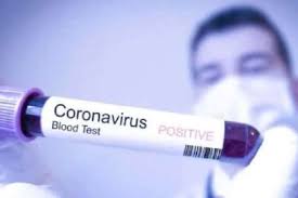 коронавірус 323232