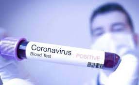 коронавірус 44402764