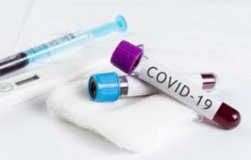 коронавірус с3 33